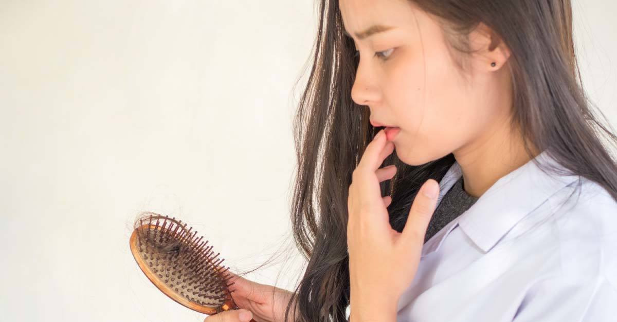 頭皮的脂漏性皮膚炎造成的掉髮如何改善？