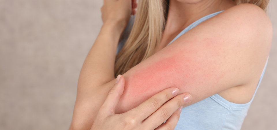 SLS到底有什麼不好呢？  最主要的擔憂是SLS對於皮膚結構的影響。相關研究指出，SLS對肌膚或眼周黏膜具有高刺激性，雖然 SLS 本身並不是致癌性成份(Carcinogen)，但由於它的高刺激性，容易使肌膚產生過敏反應，使皮膚自身的防禦能力降低，引起皮膚炎、皮膚老化等現象，若長時間使用含高濃度SLS的產品，不僅使肌膚表層變薄、乾燥，更可能有促癌的可能。  * Cosmetic Ingredient Review 的評估報告中表示，長時間接觸肌膚的產品，SLS 濃度不應超過1%。 * 臨床研究結果亦顯示，2%濃度以上的 SLS 如接觸到頭皮表層，容易引致脫髮或過敏反應，同時該研究更指出，SLS 可能會影響幼童眼睛正常發育，對成年人來說，可能導致白內障。