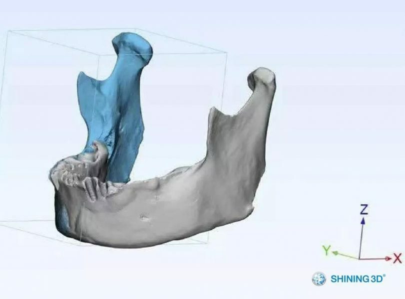 3D掃描&列印技術，重建缺失遺骨